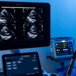 AREADECARDIOLOGIASALADEATENCION02